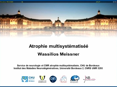 Syndromes Parkinsoniens atypiques : Atrophie multisystématisée