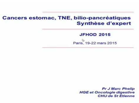 Synthèse d'expert : Cancers estomac, TNE, bilio-pancréatiques