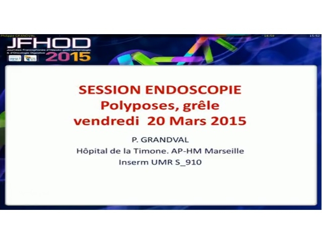 Synthèse d'expert : Endoscopie polypose et grêle