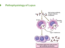 Systemic Lupus Erythematosus (SLE) in Children - Pediatrics