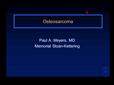 Systemic Therapy for Osteosarcoma and Ewing Sarcoma Systemic Therapy for Osteosarcoma and Ewing Sarcoma