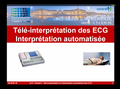 Télé-interprétation des électrocardiogrammes (ECG) : organisation pratique au Brésil. Interprétation automatisée des ECG par logiciel embarqué : évaluations publiées, confiance des praticiens dans le logiciel