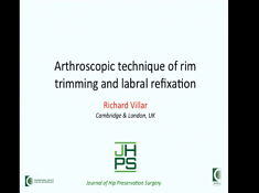 Technique arthroscopique de détourage des bords et refixation du labrum