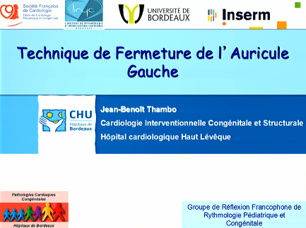 Technique de la fermeture d'auricule gauche 2015
