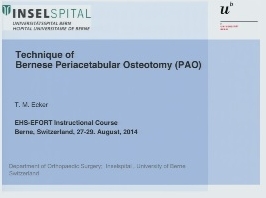 Technique Bernoise d'ostéotomie périacétabulaire