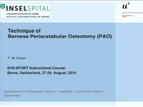Technique of Bernese periacetabular osteotomy