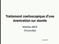 Technique par voie clioscopique d'une éventration sur stomie