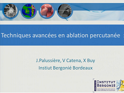 Techniques avancées en ablation percutanée