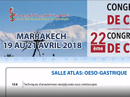 Techniques d'anastomose oesojéjunale sous coelioscopie Techniques d'anastomose oesojéjunale sous coelioscopie