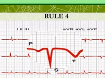 Ten rules for ECG