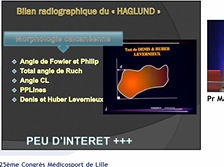 Tendinopathies d'insertion du tendon calcanéen Tendinopathies d'insertion du tendon calcanéen