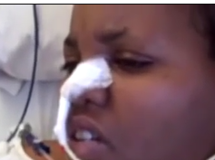 Teratoma-Induced AntiNMDA Receptor Encephalitis Teratoma-Induced AntiNMDA Receptor Encephalitis