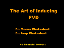 The Art of Successful Posterior Vitreous Detachment Induction The Art of Successful Posterior Vitreous Detachment Induction