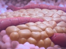 The Arthur Riggs Diabetes and Metabolism Research Institute at City of Hope