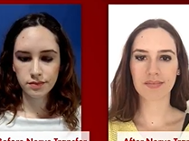 The Bionic Face. Plastic Surgery Hot Topics with Rod J. Rohrich, MD