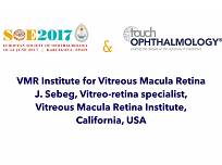 The effects of vitreous & long-term results of vitrectomy for vitreous floaters The effects of vitreous & long-term results of vitrectomy for vitreous floaters