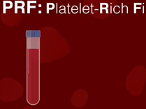 The Future of Fat- PRP vs PRF. Plastic Surgery Hot Topics with Rod J. Rohrich, MD The Future of Fat- PRP vs PRF. Plastic Surgery Hot Topics with Rod J. Rohrich, MD