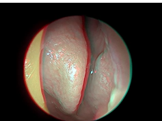 The Nose for Neurosurgeons (3D)