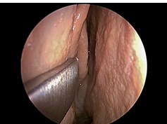 The Nose for Neurosurgeons