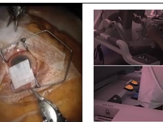 The Robotic Surgical System and the Installation The Robotic Surgical System and the Installation