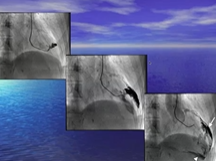 The RS Academy Class - Angiograms Discussion 20th June 2020