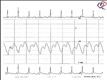 The RS Academy Class - Hemodynamic Tracings 16th June 2020