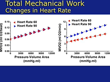 The Science and Hemodynamics of Percutaneous Mechanical Circulatory Support