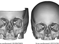 The Truth About Facial Aging: Plastic Surgery Hot Topics