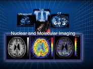 The Value of Nuclear Medicine and Molecular Imaging