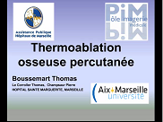 Thermoablation osseuse percutanée Thermoablation osseuse percutanée