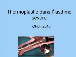 Thermoplastie dans l'asthme sévère