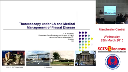 Thoracoscopy under local anaesthesia