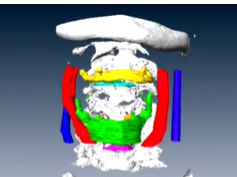 Three-dimensional Educational Computer Model of Larynx