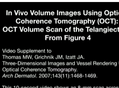 Three-Dimensional Images and Vessel Rendering Using Optical Coherence Tomography 2 Three-Dimensional Images and Vessel Rendering Using Optical Coherence Tomography 2
