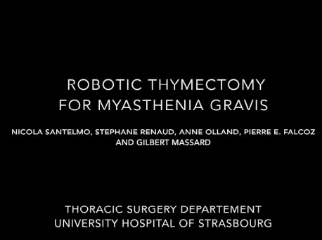 Thymectomie robotique pour la myasthénie gravis