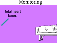 Topic 11: Intrapartum Care
