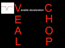 Topic 26: Intrapartum Fetal Surveillance