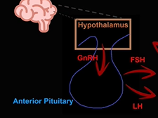 Topic 43: Amenorrhea