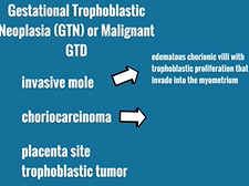 Topic 50: Gestational Trophoblastic Neoplasia