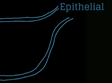 Topic 55: Ovarian Neoplasms