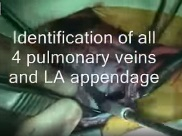 Total anomalous pulmonary venous connection