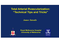 Total arterial revascularisation: technical tips and tricks Total arterial revascularisation: technical tips and tricks