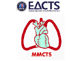 Totally thoracoscopic left atrial occlusion concomitant to (EACAB)