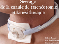 Trachéotomie -Sevrage