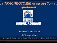 Trachéotomie