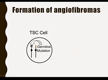 Track 3 TSC Adult - New Treatment Options for Skin Manifestations in TSC Track 3 TSC Adult - New Treatment Options for Skin Manifestations in TSC