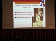 Traitement chirurgical de linstabilité latérale de la cheville