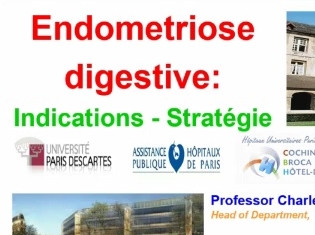 Traitement chirurgical : indications et stratégie