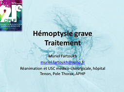 Traitement des hémoptysies graves