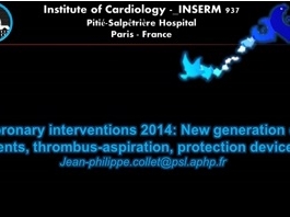 Traitement du syndrome coronarien aigu - Les nouvelles techniques d'angioplastie vasculaire Traitement du syndrome coronarien aigu - Les nouvelles techniques d'angioplastie vasculaire